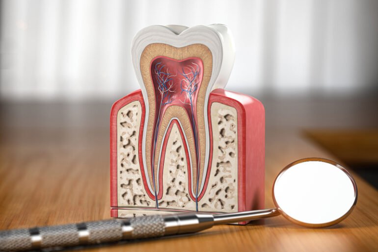 Qu Es Una Endodoncia Todo Lo Que Necesitas Saber Cl Nica Dental M M