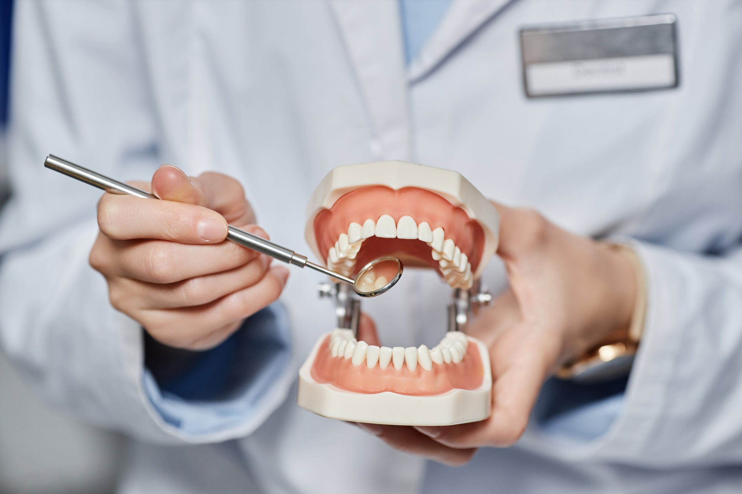 Modelo dental de mandíbula con empaste siendo examinado por dentista para educación sobre empastes mal hechos.